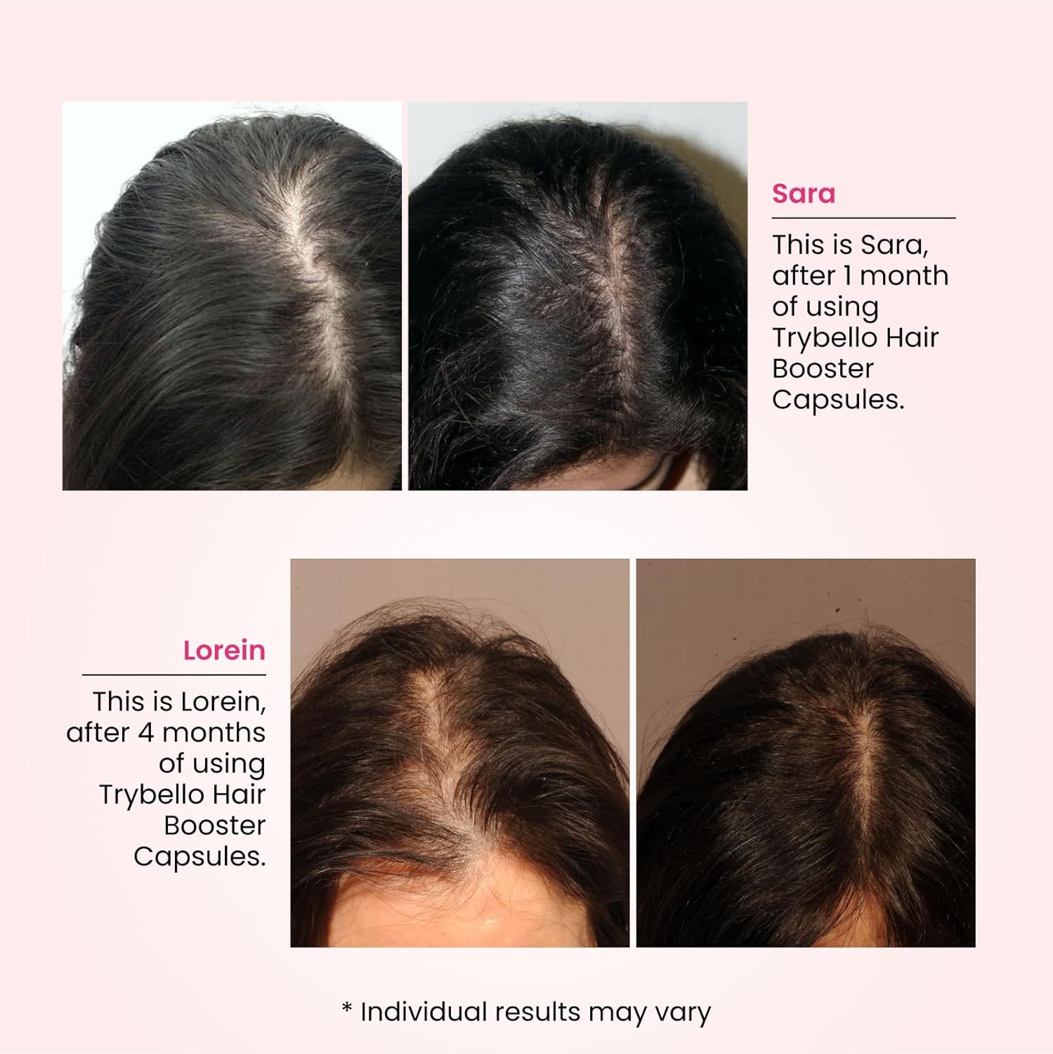 Trybello Daily Hair Booster Capsules | Collagen & Biotin Complex for Women | Multivitamin Supplement for Thicker, Fuller Growth & Strength | Hair Loss Treatment for Thinning Strands | 60 Capsules