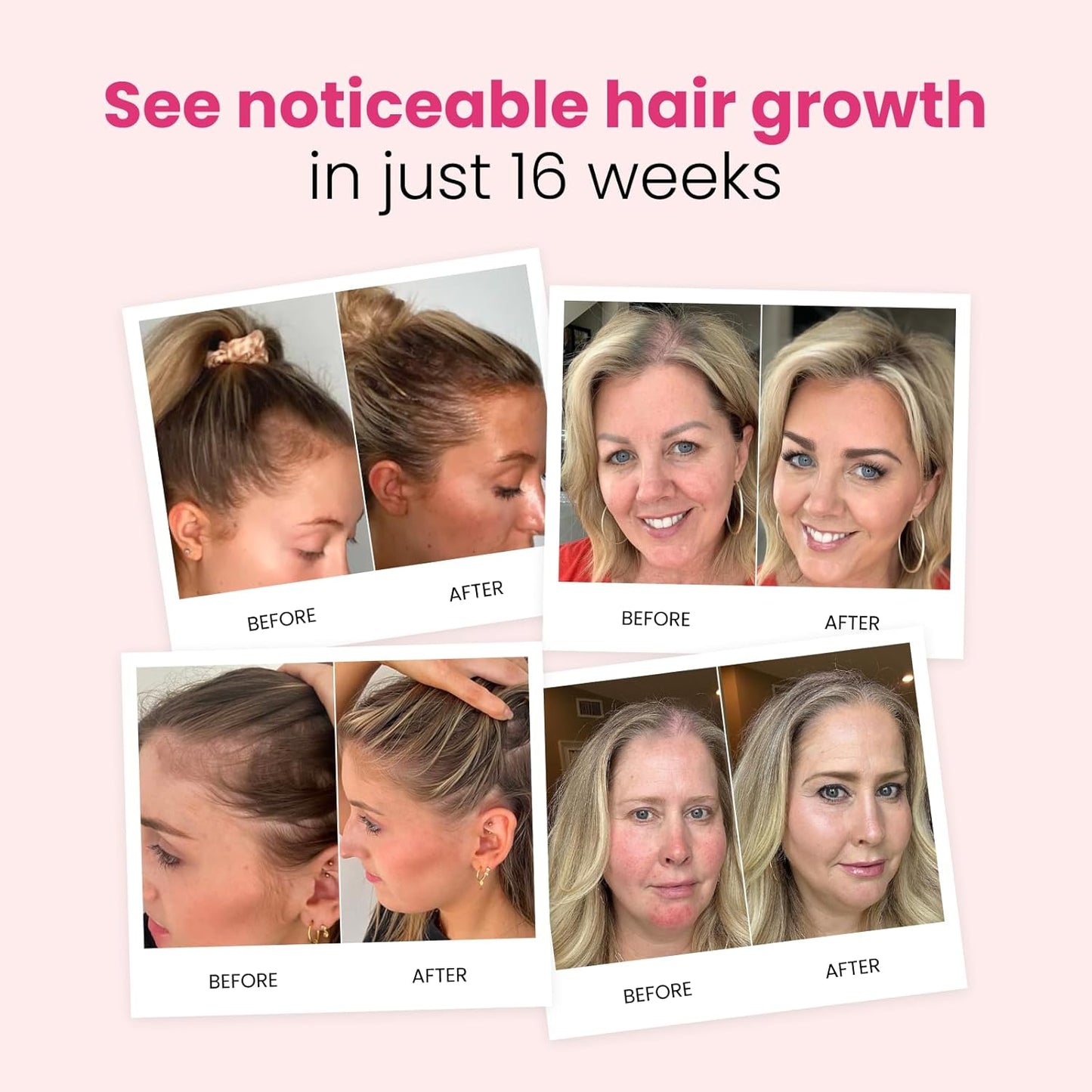 Trybello Hair Growth Shampoo & Strengthening Conditioner Set | with Biotin, Turmeric & Ginger | Anti-Hair Fall, Sulfate Free, Paraben Free | Hair Regrowth Support for Fuller, Healthier Strands