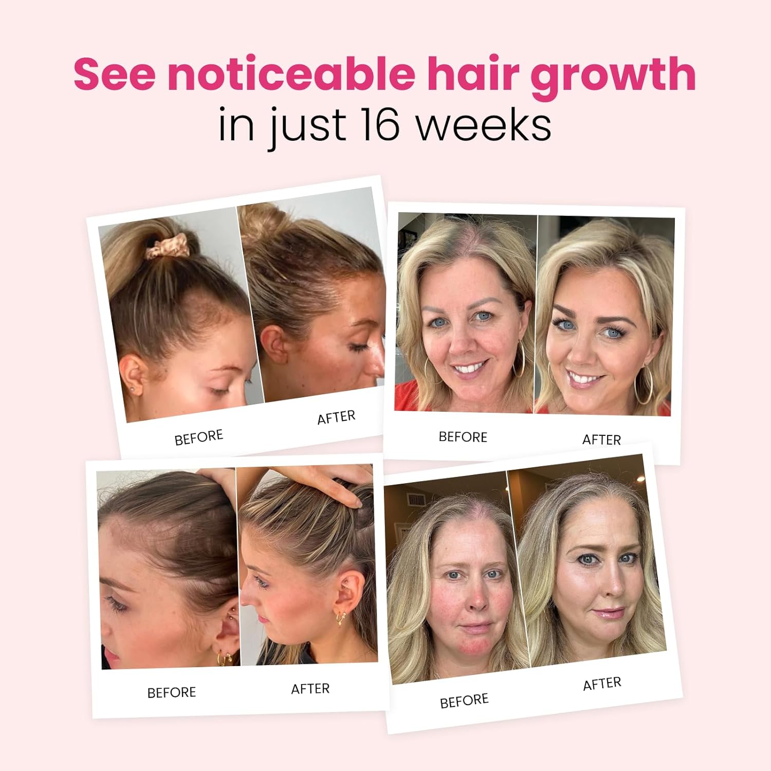 Trybello Hair Growth Shampoo & Strengthening Conditioner Set | with Biotin, Turmeric & Ginger | Anti-Hair Fall, Sulfate Free, Paraben Free | Hair Regrowth Support for Fuller, Healthier Strands